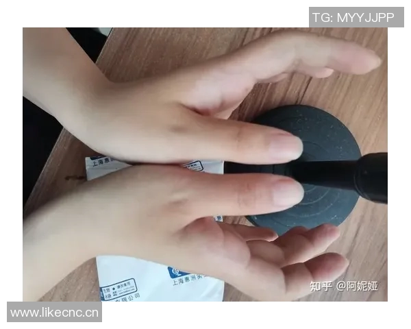 梅尔顿因旧伤复发赛后冰敷右手预计几天后恢复正常状态 梅尔顿因旧伤复发赛后冰敷右手预计几天后恢复正常状态